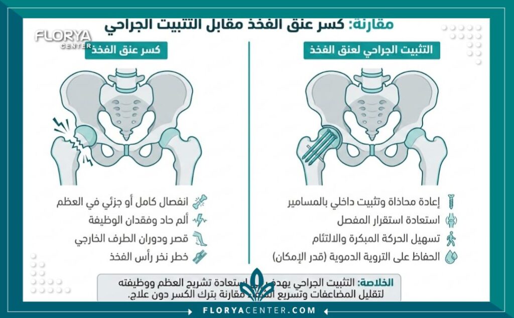 إنفوجرافيك مقارنة بين شكل كسر عنق الفخذ قبل وبعد عملية تثبيت كسر عنق الفخذ.