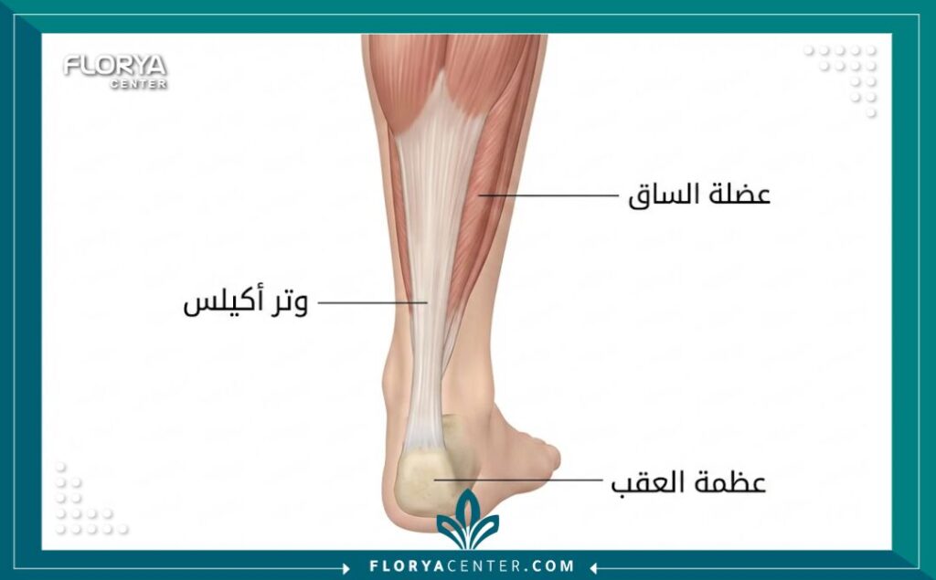 رسم تخطيطي طبي يوضح تشريح وتر أكيلس وموقع عضلة الساق وعظمة العقب.