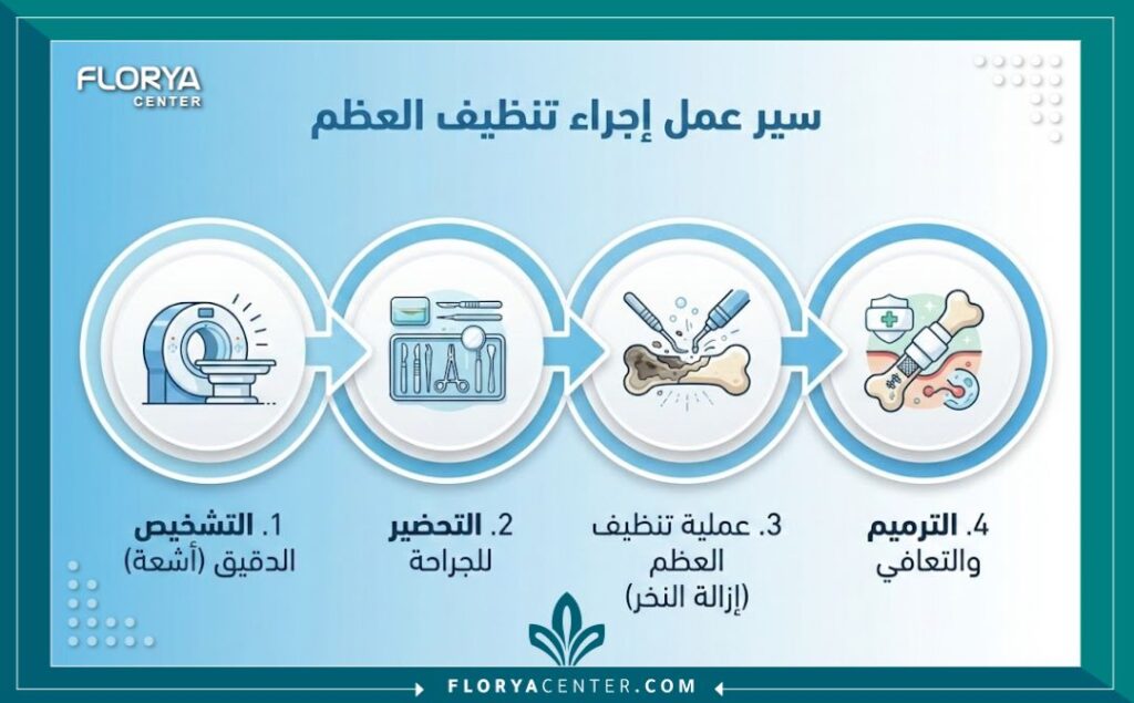 عملية تنظيف تسوس العظام 3 انفوجرافيك بياني يوضح خطوات مراحل عملية تنظيف وعلاج تسوس العظام، بدءاً من التشخيص بالأشعة وحتى مرحلة الترميم والتعافي.