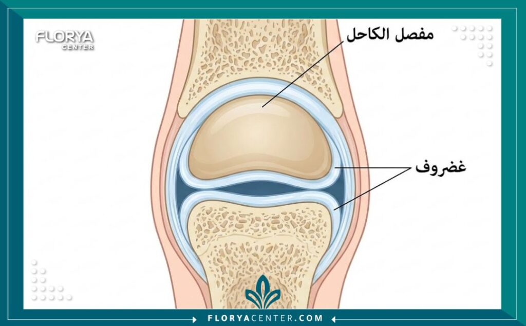رسم تخطيطي طبي يوضح تشريح مفصل الكاحل وموقع الغضروف المتضرر الذي يحتاج للتنظيف.