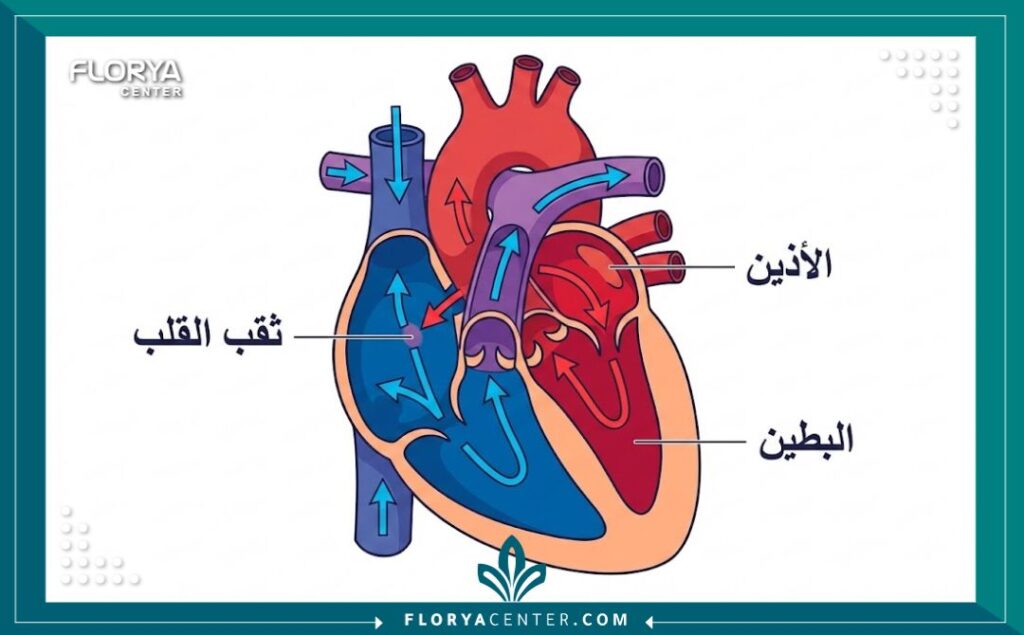 رسم توضيحي طبي دقيق يشرح مكان ثقب القلب عند الأطفال وتأثيره على الدورة الدموية.