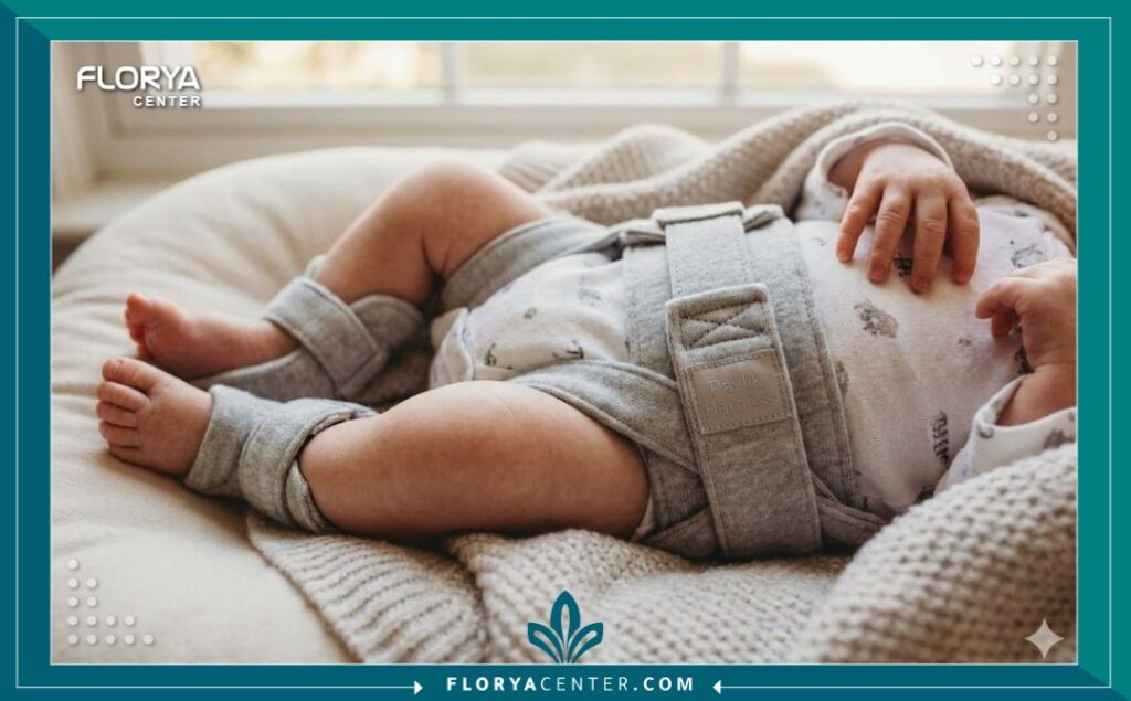 الطفل بعد عملية رد خلع الورك الولادي ووضع الجبيرة الطبية لضمان استقرار المفصل.