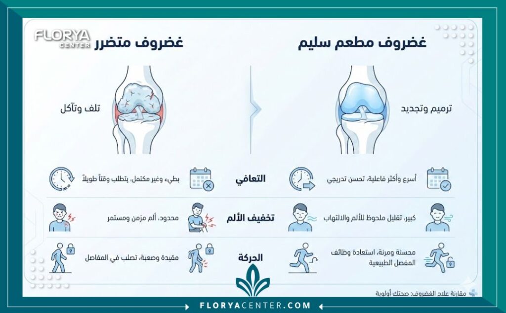 إنفوجرافيك يقارن بين الغضروف المتآكل والغضروف السليم بعد عملية زراعة الغضاريف.