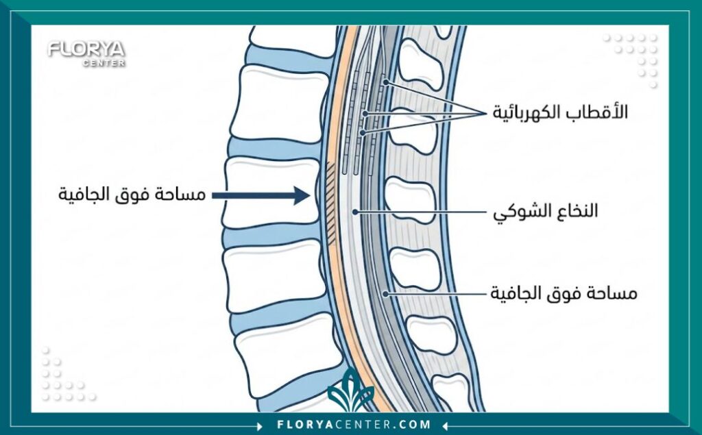 عملية زراعة محفز العصب الشوكي 1 - عملية زراعة محفز العصب الشوكي تعد عملية زراعة محفز العصب الشوكي (Spinal Cord Stimulator) خياراً متطوراً في مركز فلوريا لعلاج الآلام المزمنة التي لا تستجيب للحلول التقليدية الجراحية أو الدوائية.
