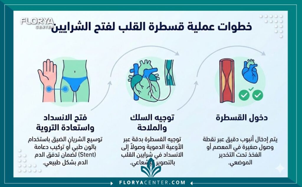 إنفوجرافيك يوضح قسطرة القلب لفتح الشرايين التداخلية الثلاث الأساسية: إدخال القسطرة، توجيه السلك، وفتح الشريان المسدود واستعادة التروية الدموية.