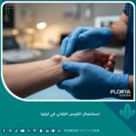 عملية استئصال الكيس الزلالي في المعصم في تركيا بأحدث التقنيات الجراحية.