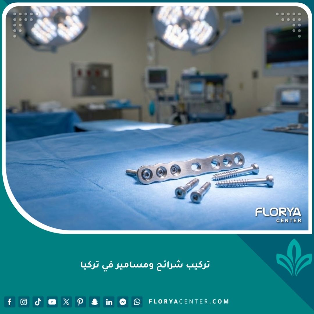 واجهة مقال عن عملية تركيب شرائح ومسامير طبية لتثبيت العظام في تركيا بأحدث التقنيات.