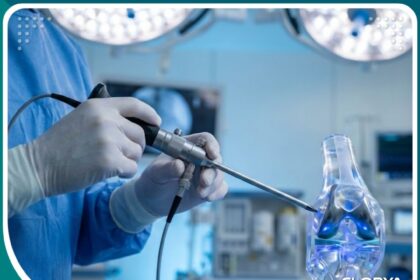 عملية تنظير الركبة في تركيا بأحدث التقنيات الطبية العالمية.