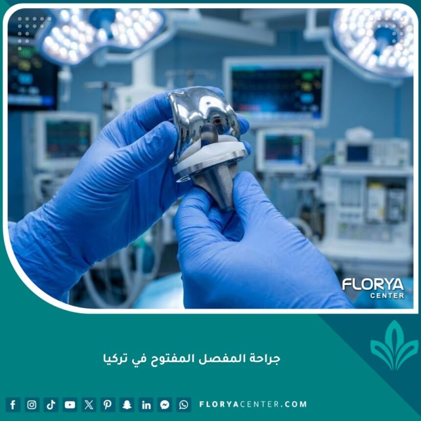 جراحة المفصل المفتوح في تركيا - طبيب جراح يحمل مفصلًا صناعيًا متطورًا في غرفة عمليات حديثة.
