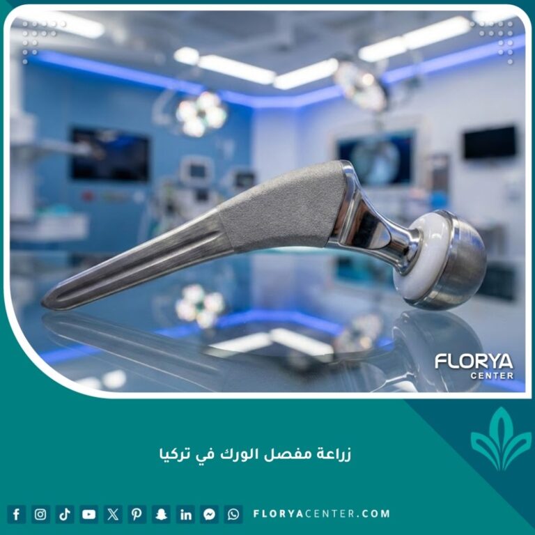 واجهة مقال حول زراعة مفصل الورك في تركيا تظهر مفصلًا صناعيًا حديثًا بتقنية متطورة.
