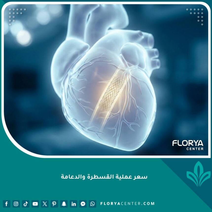 صورة سينمائية توضح عملية تركيب دعامة القلب والقسطرة بدقة عالية.