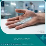 عملية إصبع الزناد في تركيا: الواجهة الرئيسية للخدمات الطبية المتقدمة.