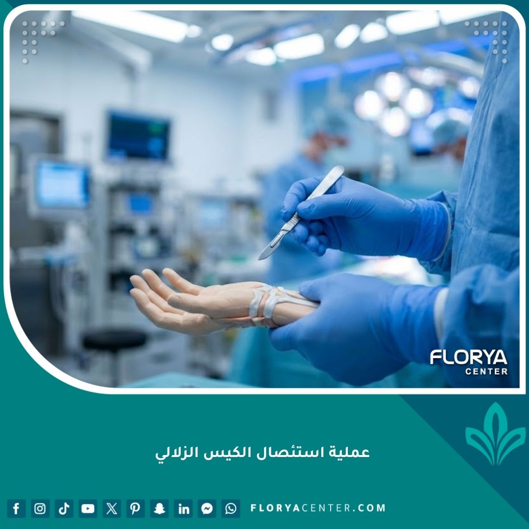 جراح متخصص يجري تحضيرات عملية استئصال الكيس الزلالي في بيئة طبية معقمة.