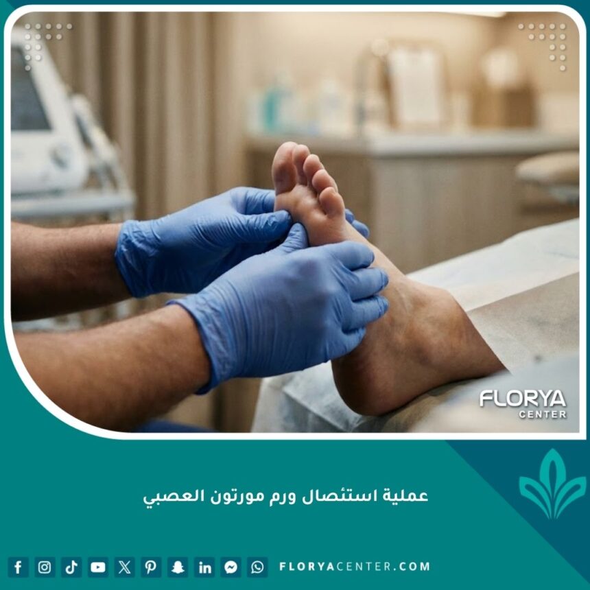 صورة احترافية لعملية فحص ورم مورتون العصبي في القدم قبل الاستئصال الجراحي.