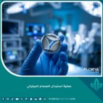 عملية استبدال الصمام الميترالي - صمام قلبي صناعي حديث في غرفة عمليات متطورة.