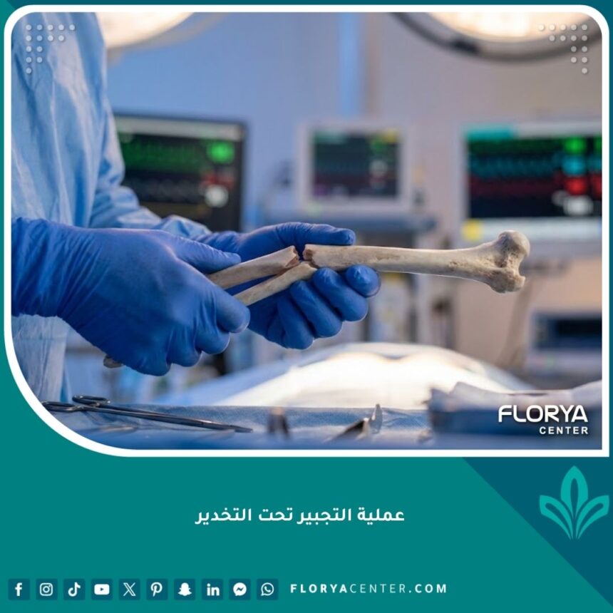 جراح عظام يقوم بعملية تجبير كسر تحت التخدير في غرفة عمليات حديثة.