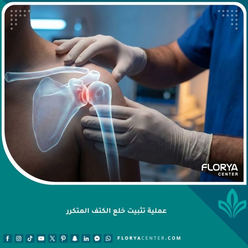 عملية تثبيت خلع الكتف المتكرر جراحياً باستخدام أحدث التقنيات الطبية