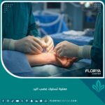 عملية تسليك عصب اليد جراحياً بأحدث التقنيات الطبية لإنهاء خدر وتنميل الأصابع.