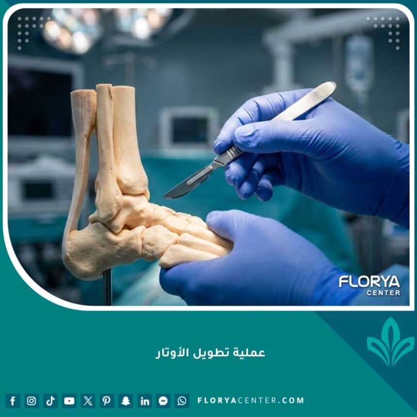 صورة احترافية جراحية لعملية تطويل الأوتار في غرفة عمليات حديثة.