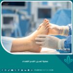 صورة مميزة لعملية تعديل القدم القفداء تظهر نجاح الجراحة في تصحيح شكل القدم.