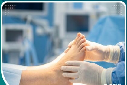 صورة مميزة لعملية تعديل القدم القفداء تظهر نجاح الجراحة في تصحيح شكل القدم.