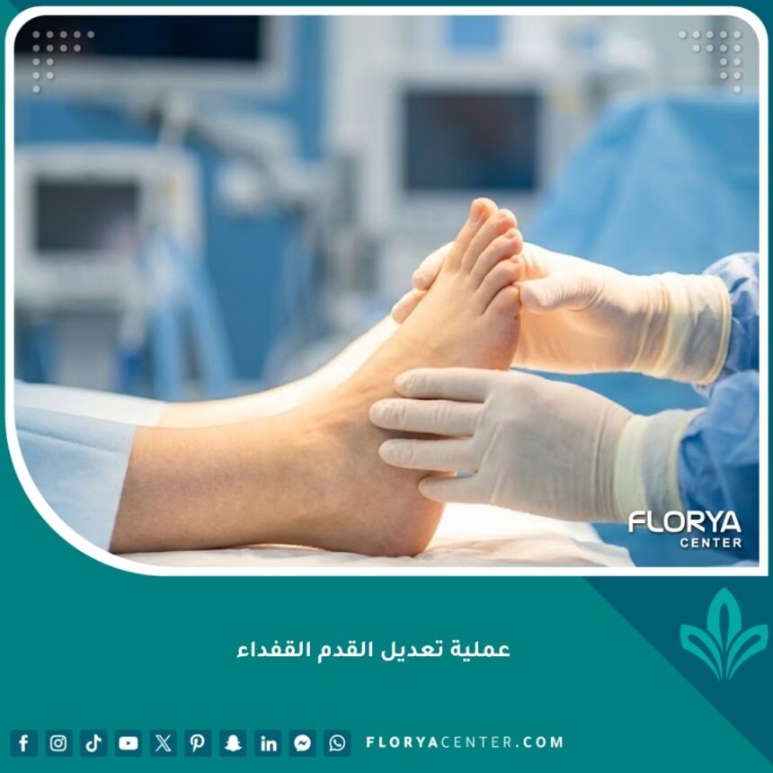 صورة مميزة لعملية تعديل القدم القفداء تظهر نجاح الجراحة في تصحيح شكل القدم.