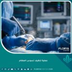صورة احترافية عالية الدقة تظهر جراح عظام مختص يقوم بعملية دقيقة لتنظيف تسوس ونخر العظام باستخدام أدوات طبية متطورة داخل غرفة عمليات معقمة.