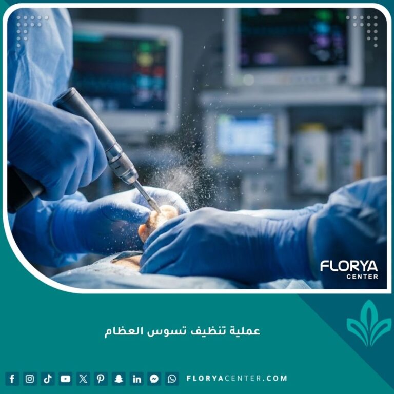 صورة احترافية عالية الدقة تظهر جراح عظام مختص يقوم بعملية دقيقة لتنظيف تسوس ونخر العظام باستخدام أدوات طبية متطورة داخل غرفة عمليات معقمة.