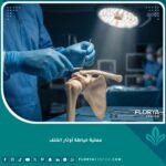 صورة احترافية تجسد دقة عملية خياطة أوتار الكتف الممزقة في مستشفى حديث.
