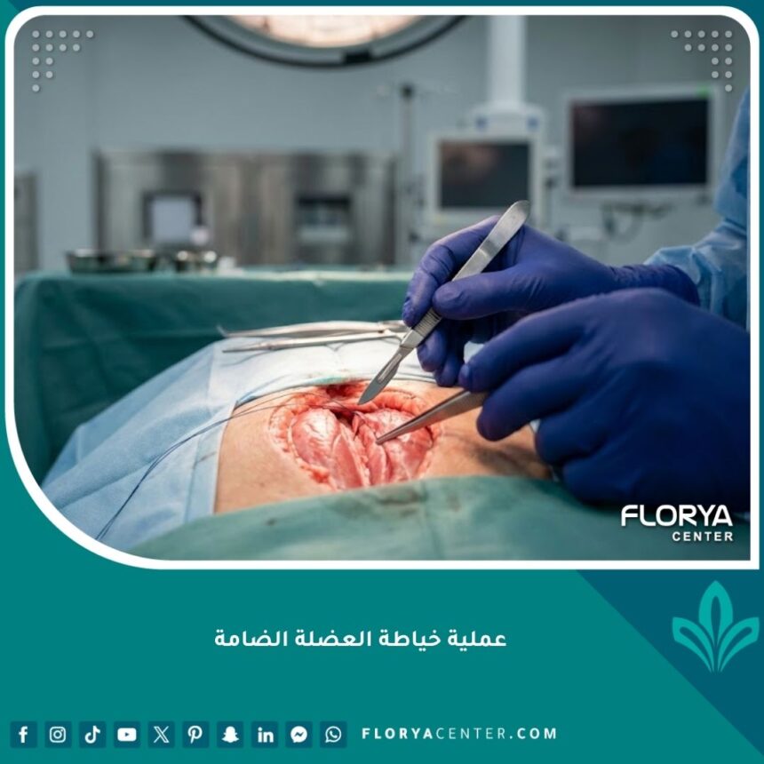 صورة سينمائية لعملية خياطة العضلة الضامة تبرز دقة الجراحة الرياضية الحديثة.