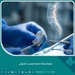 جهاز محفز العصب الشوكي المتطور المستخدم في علاج آلام الظهر المزمنة.
