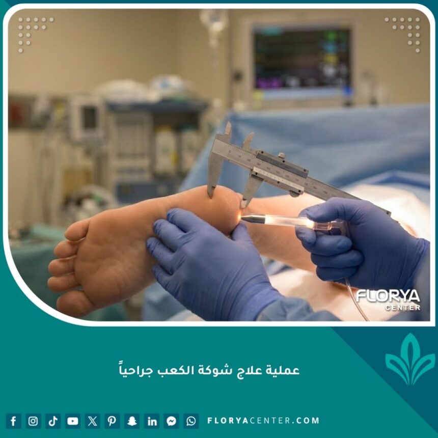 عملية جراحية لإزالة شوكة الكعب في مستشفى حديث بأحدث التقنيات.