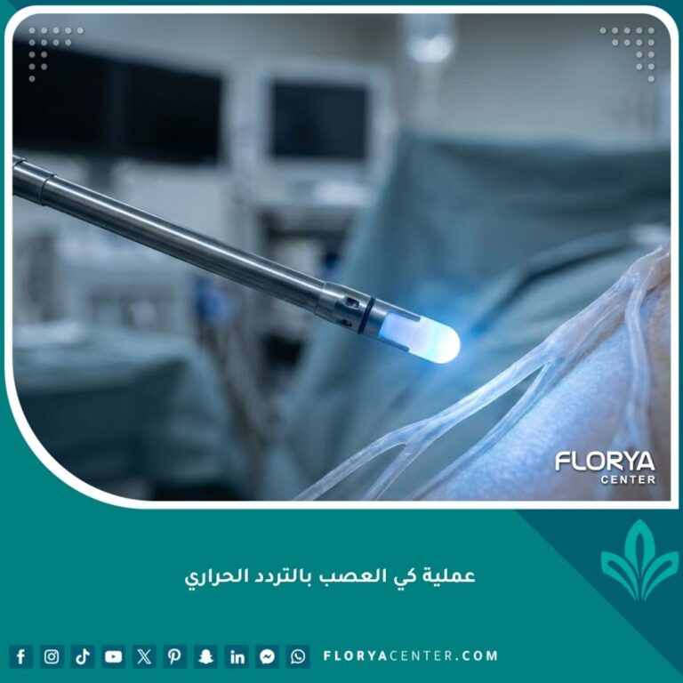 واجهة مقال عن عملية كي العصب بالتردد الحراري لعلاج آلام العمود الفقري بتقنيات حديثة.