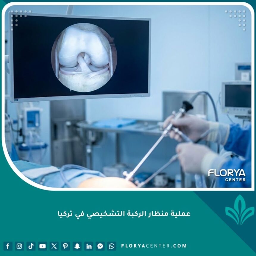 واجهة عملية منظار الركبة التشخيصي في تركيا داخل غرفة عمليات متطورة بأحدث التقنيات.