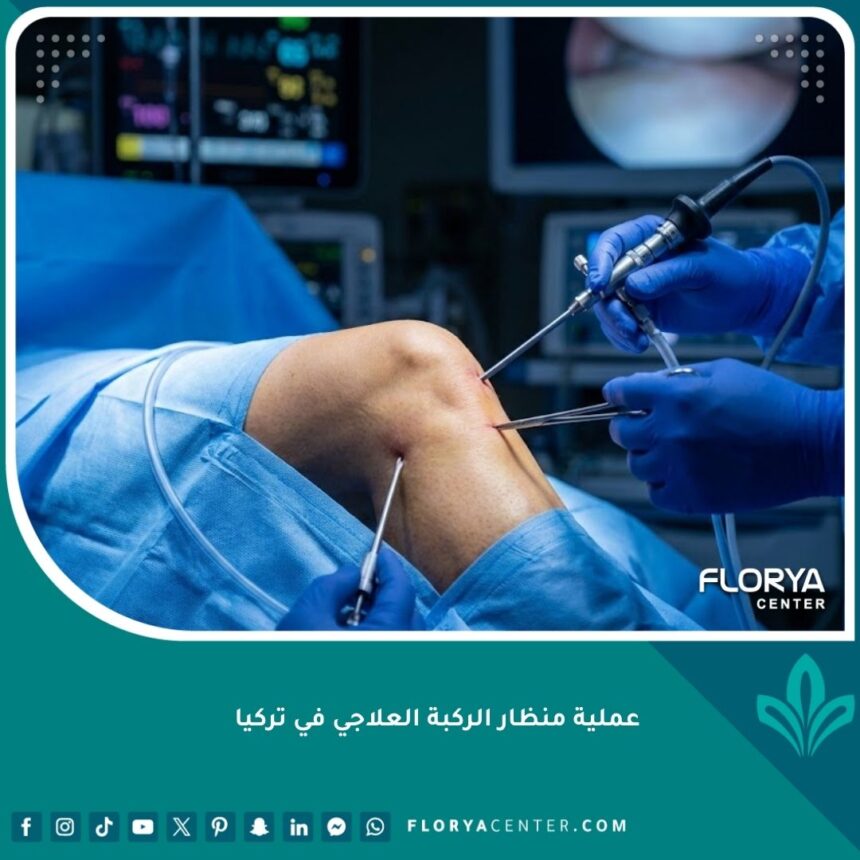 صورة احترافية لعملية منظار الركبة العلاجي في تركيا داخل غرفة عمليات حديثة.