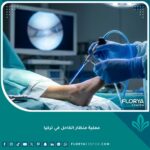 عملية منظار الكاحل في تركيا باستخدام أحدث التقنيات الجراحية في مستشفى متطور.
