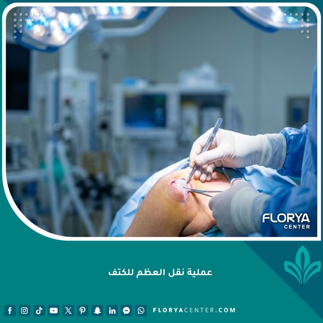 صورة احترافية لعملية نقل العظم للكتف في مستشفى حديث.