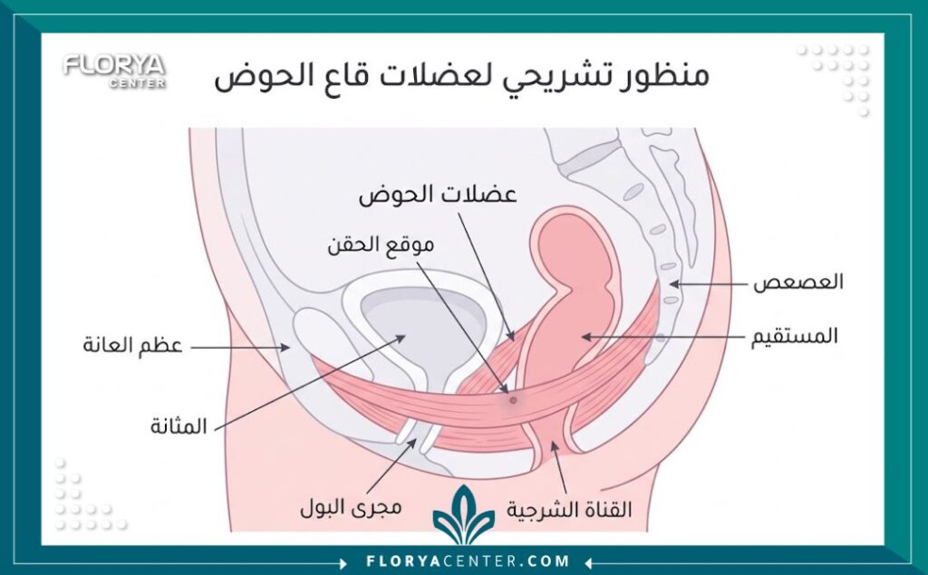 رسم تخطيطي طبي يوضح تشريح عضلات الحوض وأماكن حقن البوتكس لعلاج التشنج المهبلي.