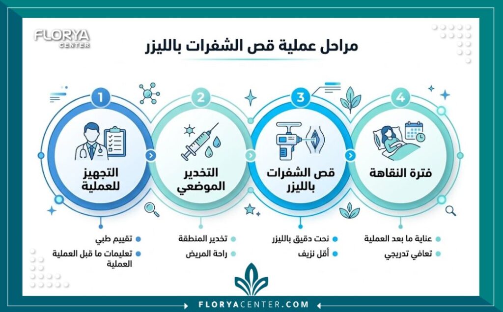إنفوجرافيك يشرح خطوات تجربتي مع قص الشفرات في تركيا من التحضير حتى التعافي.