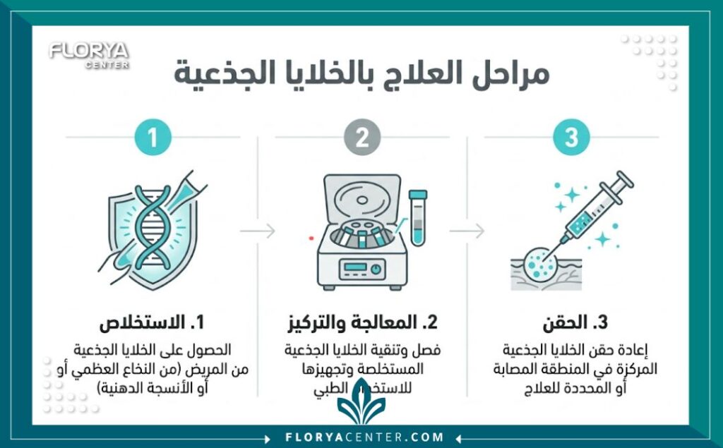 إنفوجرافيك يوضح مراحل عملية حقن الخلايا الجذعية للذكر في العيادات التركية.