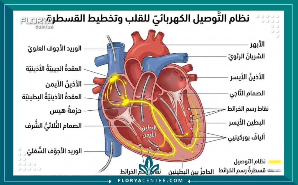 رسم تخطيطي طبي لتشريح القلب يوضح نظام التوصيل الكهربائي وأماكن وضع القساطر أثناء الدراسة الكهروفيزيولوجية (EPS) مع تسميات باللغة العربية.