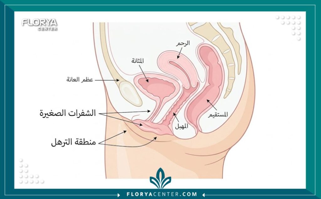 رسم تخطيطي طبي يوضح تشريح منطقة الشفرات المترهلة وكيفية معالجتها.