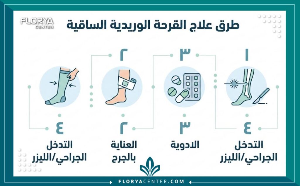 إنفوجرافيك يوضح الخيارات علاج القرحة الوريدية وتشمل الضغط والعناية بالجروح.