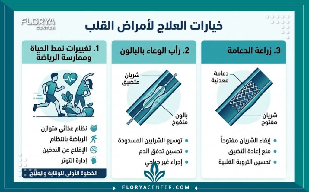 إنفوجرافيك يوضح خيارات علاج انسداد شرايين الساق من القسطرة إلى تغيير نمط الحياة.