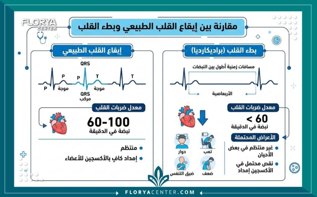 إنفوجرافيك طبي يقارن بين نبض القلب الطبيعي وعلاج بطء دقات القلب مع توضيح الأعراض الشائعة.