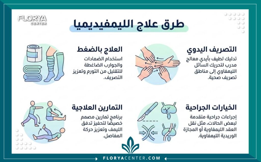 إنفوجرافيك يوضح طرق علاج ليمفيديميا (تورم الساقين) المختلفة بما في ذلك العلاج بالضغط، التدليك، والتدخل الجراحي باللغة العربية.