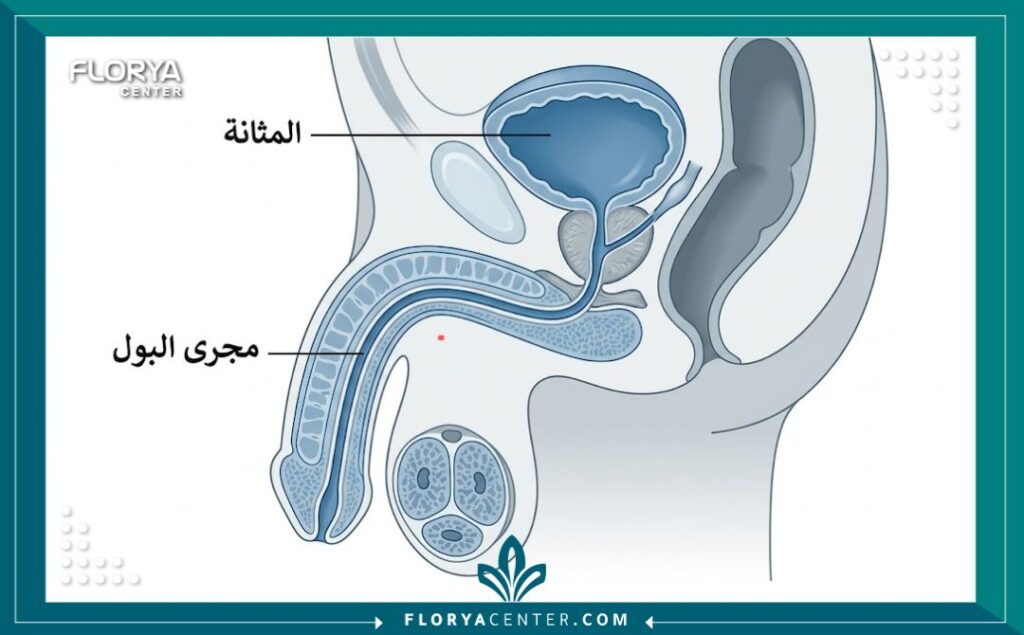 مخطط طبي يوضح تشريح مجرى البول والمثانة لعملية إحليل المسالك البولية.