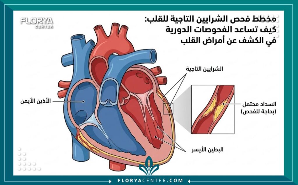 رسم توضيحي طبي لتشريح القلب يوضح الشرايين التاجية وأهمية الفحص الدوري.