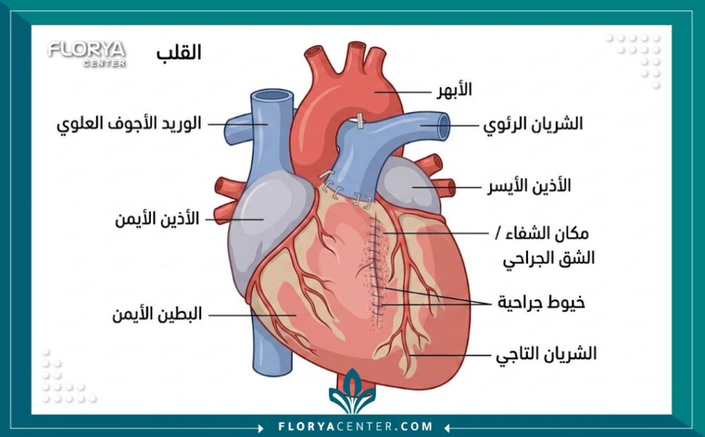 مخطط طبي يوضح تشريح القلب ومراحل التئام الجرح بعد الجراحة