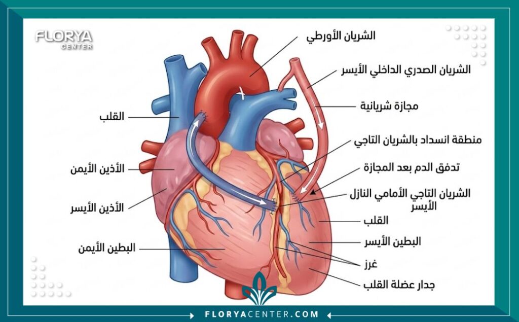 رسم تخطيطي طبي يوضح تشريح القلب وكيفية إجراء عملية القلب المفتوح بدقة.